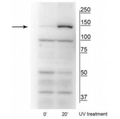 Western Blot: FANCI [p Ser559] Antibody [NBP2-60781]